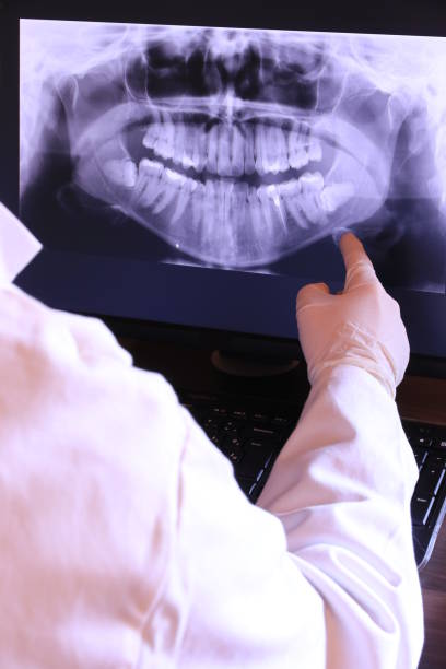 Best Urgent Tooth Repair  in Lakeview, CA