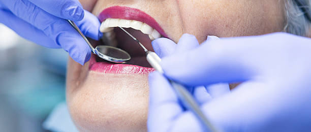 Best Emergency Tooth Extraction  in Lakeview, CA
